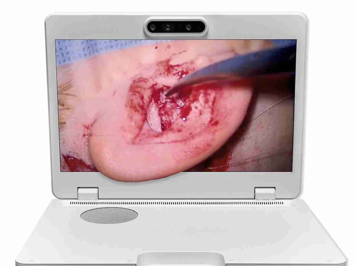 达擎之＂Heads-up 3D显微手术显示系统＂，，，整合4K裸眼3D显示及眼球追踪系统，，，，具备快速追踪人眼移动位置功能，，减轻医师长时间维持固定姿势的负担，，，让医师能有更宽广清晰的3D立体视野及更舒适的姿势来执行手术。。。